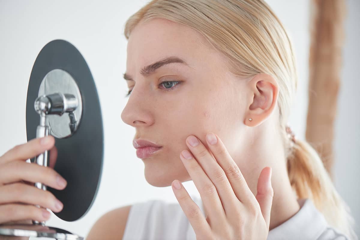 Acne-Pic Acne-Pic