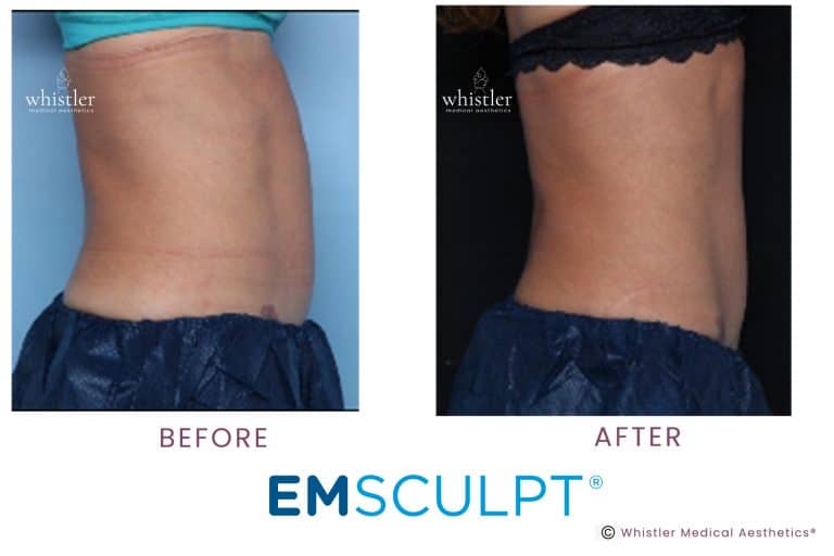 Anghela-Side-before-after--768x512