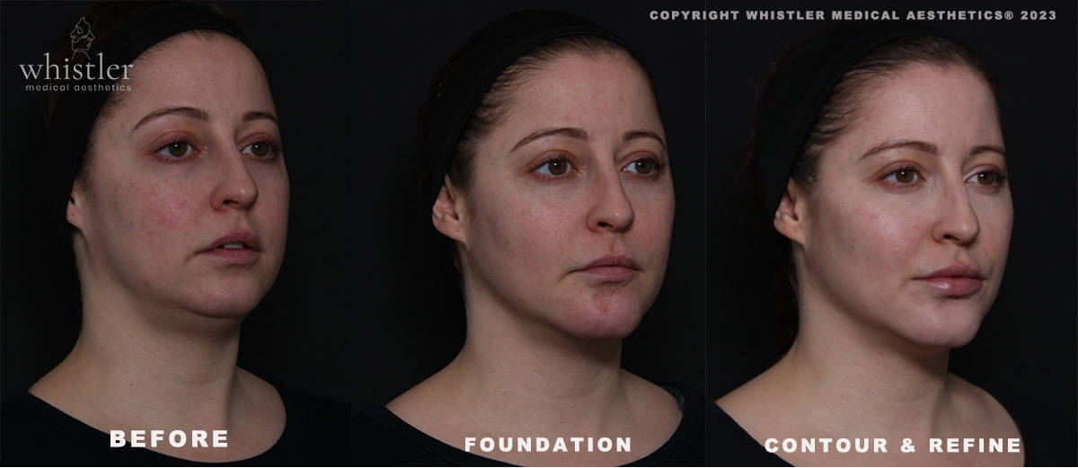 MD CODES FOUNDATION CONTOUR REFINE with Holistic planning