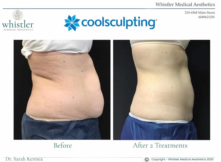 Creating a Curvy Waistline