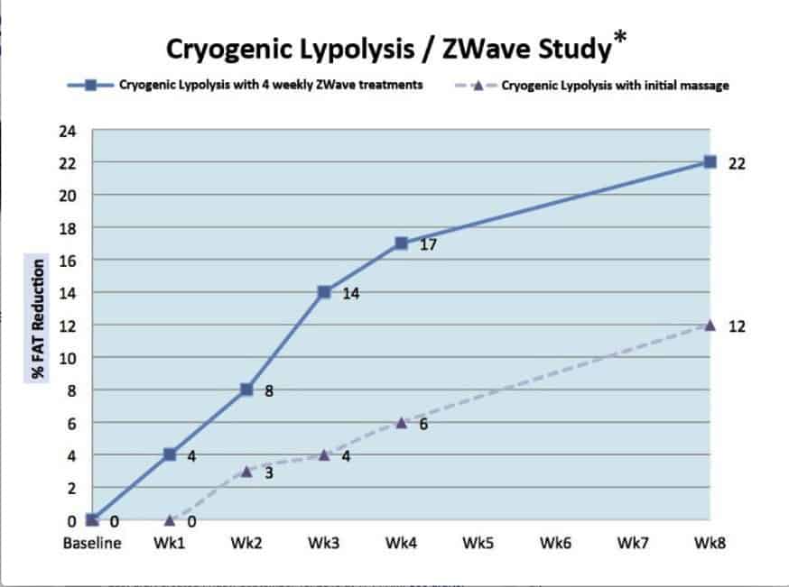 How Zwave treatments enhance patient outcomes