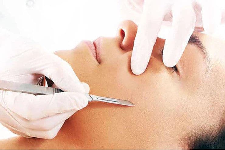 derma-planing