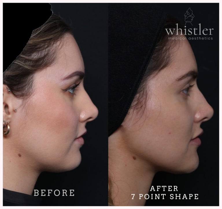 super-jawline