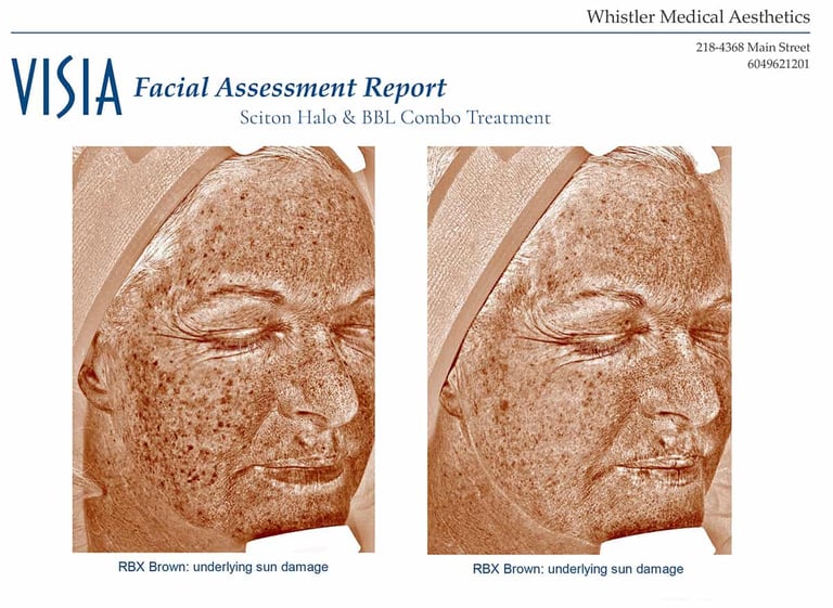 wendy-sun-damage-side