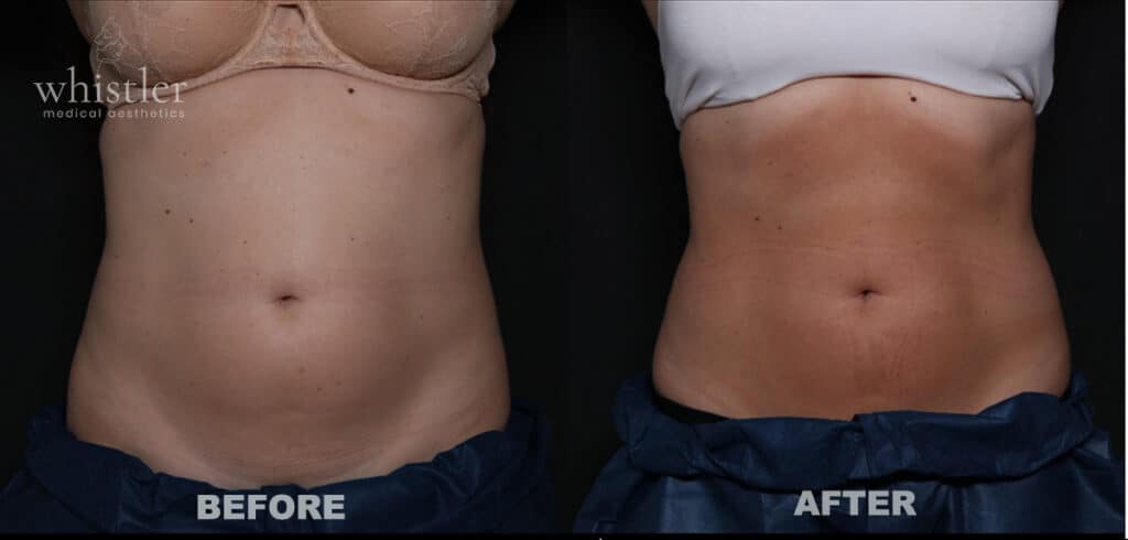 BEFORE-AFTER-SEPT-23-CS-NEO-1024x490