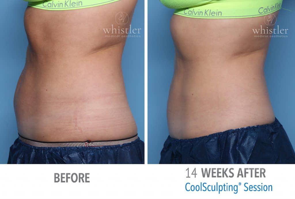 Calvin-Klein-web-before-after-1024x691