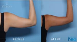 FEMALE-JAN-2022-ARMS-FLEXED-300x163