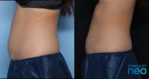 Female-NEo-side-view-300x159