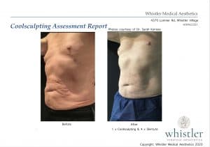 Male-before-and-after-multi-mode-300x211