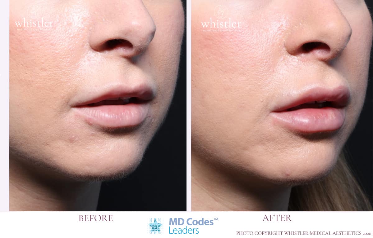 Lips by Dr Kennea