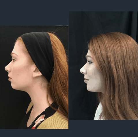 MJ Facial Aesthetics Profile Left