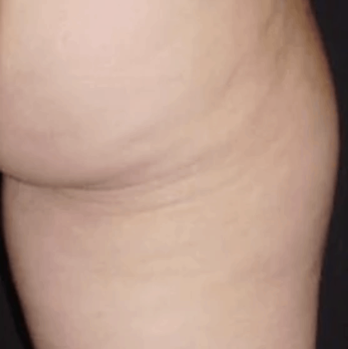 Z-Wave Pro Treatment After