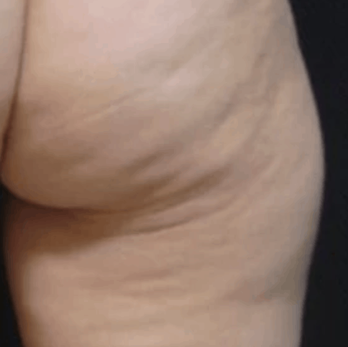 Z-Wave Pro Treatment Before