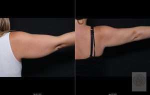 shared38-300x190